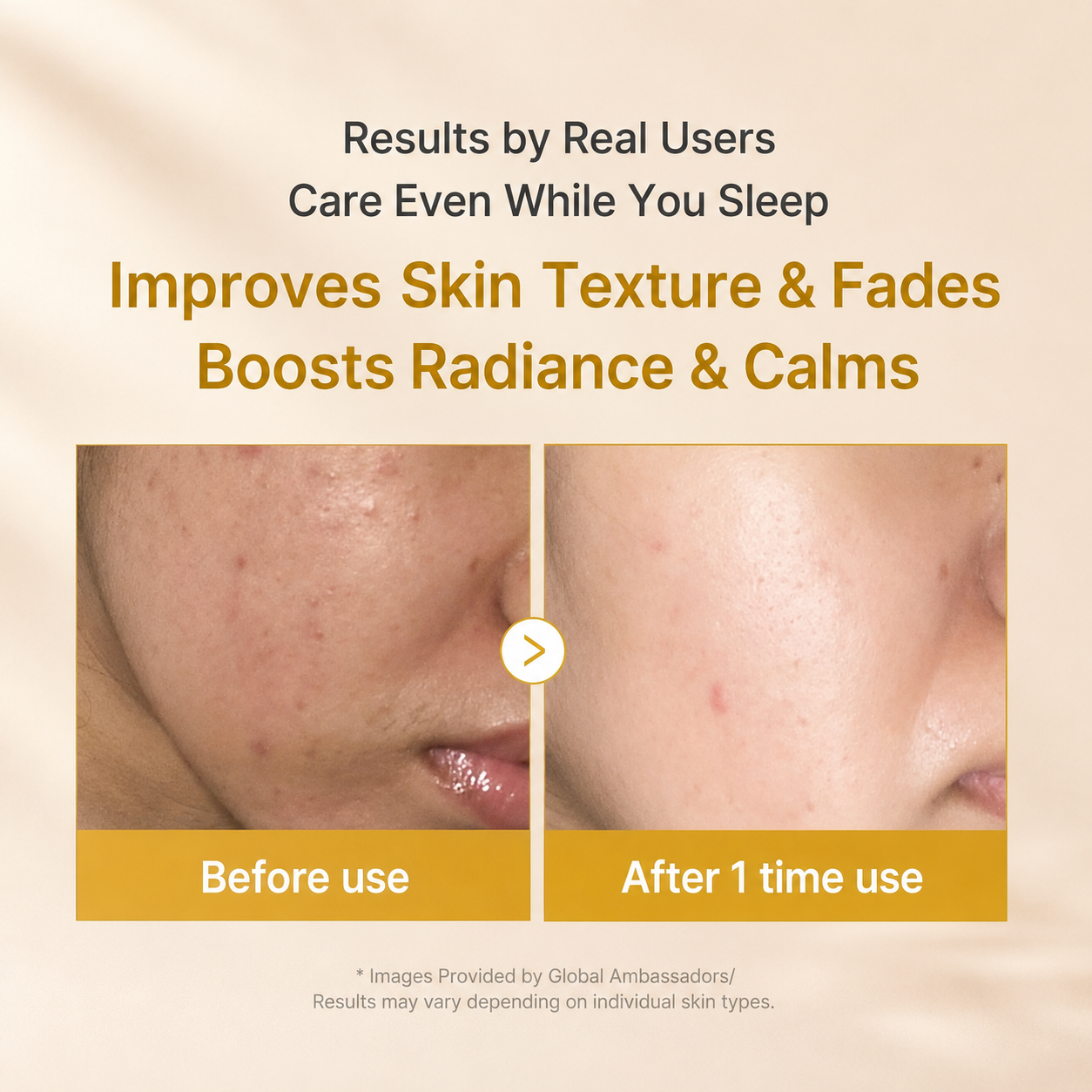 MEDICUBE - Kojic Acid Turmeric Overnight Wrapping Mask